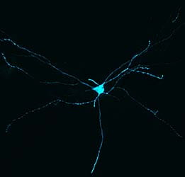 Figure 1: A motor neuron in the cervical spinal cord is fluorescently labeled following injection of adeno-associated virus into muscle.